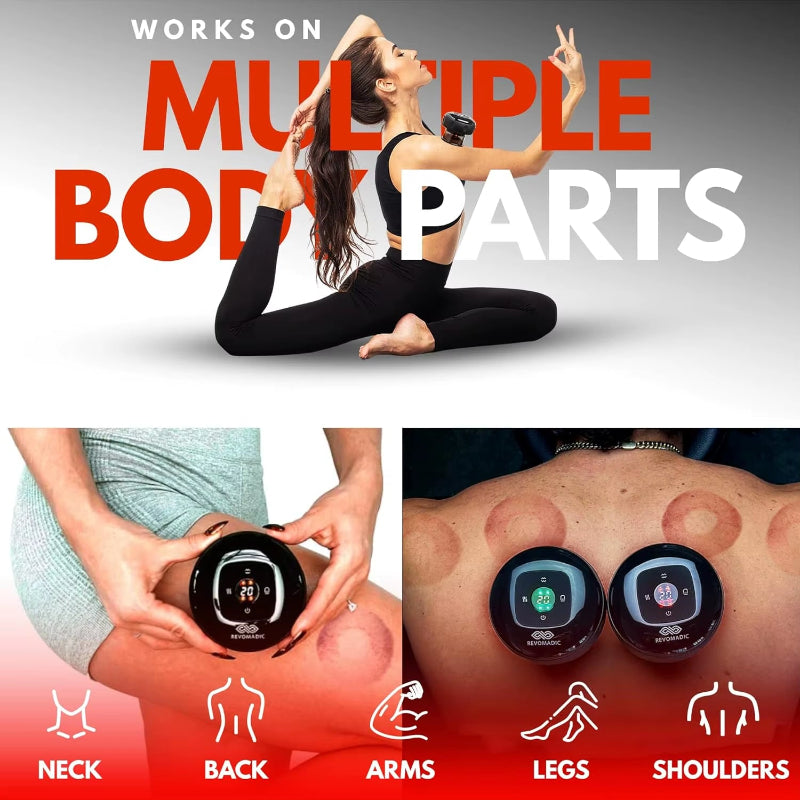 ThermoCupp™ Smart Cupping Therapy Massager